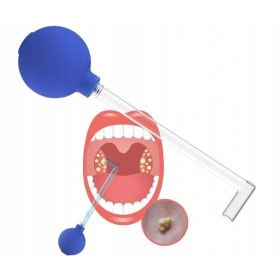   Instrument manual de curățare amigdalelor pentru îndepărtarea pietrelor pere