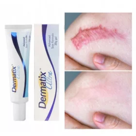  Gel Ultra Dermatix pentru Tratamentul Cicatricilor 15g - Protecție și Regenerare Eficientă