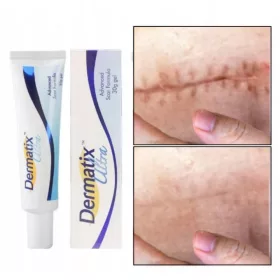   Gel Dermatix Ultra pentru Tratamentul Cicatricelor, 15g - Efectiv și Ușor de Utilizat